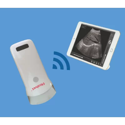 Sonda Standard Convessa a Ultrasuoni Wireless (Raggio di 60 mm)