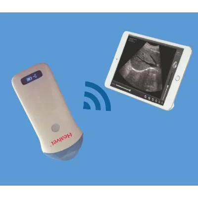 Microsonda Convessa a Ultrasuoni Wireless (Raggio di 20 mm)