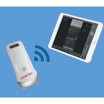 Wireless Ultrasound Linear Array Probe (40mm Radius)